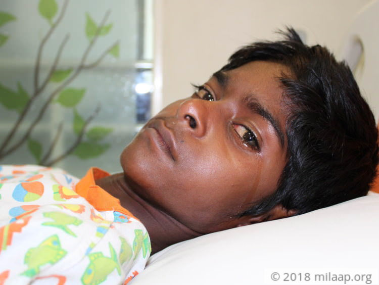 13YearOld With A Funnel Shaped Chest Has A Heart Disease Milaap